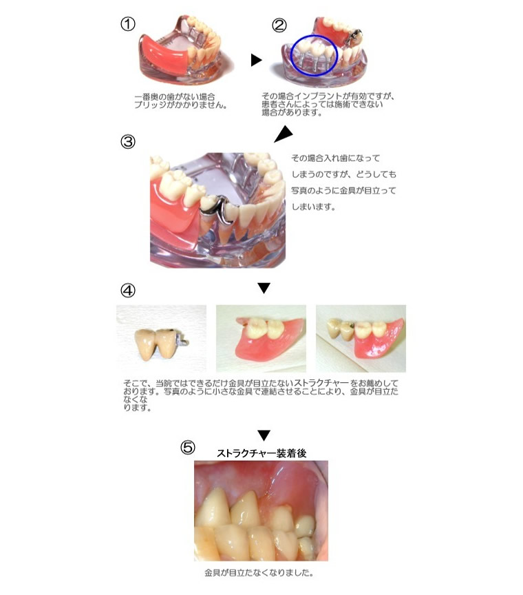 症例①