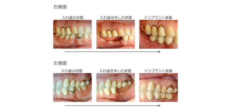 症例②