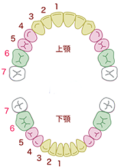 [step4]　口腔内セット