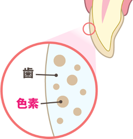 ホワイトニングのメカニズム ①